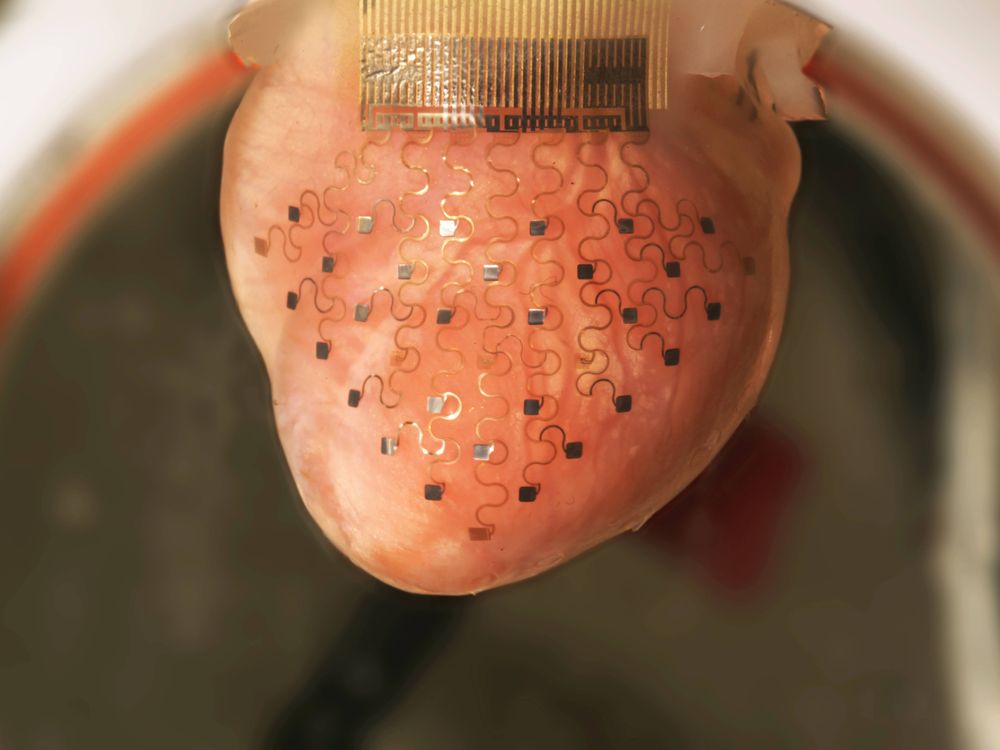 This Wearable ‘Heart Sock’ May Someday Save Lives