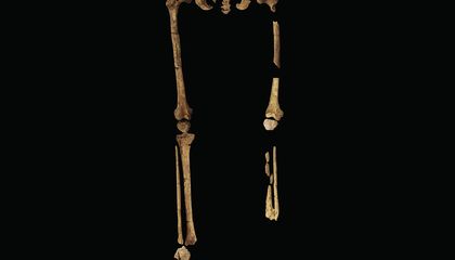 Earliest Known Amputation Was Performed in Borneo 31,000 Years Ago