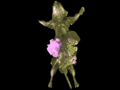Bioluminescent cancer cells appear in a three-dimensional scan of a mouse with cleared tissue. 