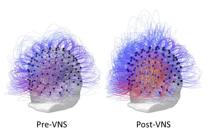 Vegetative State