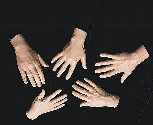 Five of a series of ten plaster hand cast created by brain surgery pioneer Harvey Cushing of his surgical peers, 1920s