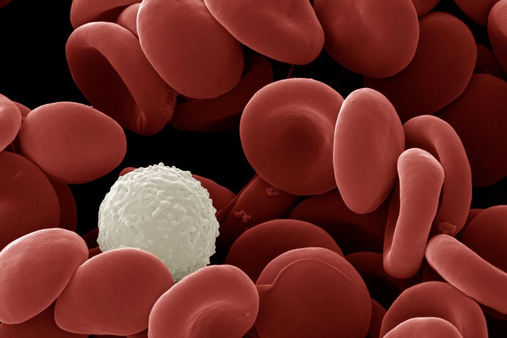 09_22_2014_cells.jpg