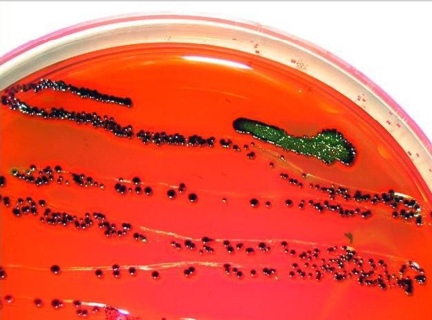 A close-up shot of E. coli growing on a petri dish. The dish has a bright red solution in it, and the bacteria looks like small green beads clustered together.