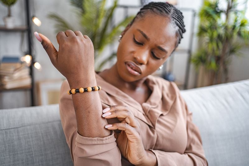 A woman itches her arm