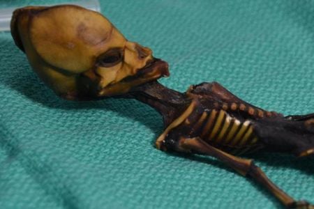 Researchers have analyzed the DNA of this mummified specimen from Atacama region of Chile.

