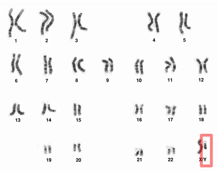 Chromosome Y in red, next to the much larger X chromosome