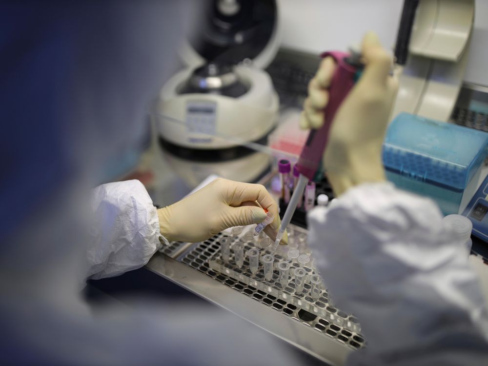 A medical staffer works with test systems for the diagnosis of coronavirus