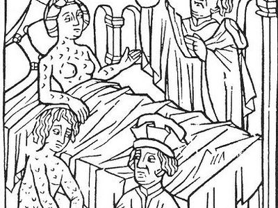 The earliest known portrayal of patients suffering from syphilis, from Vienna in 1498.