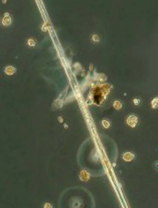 Amphisolenia-hires-11-157x300.jpg