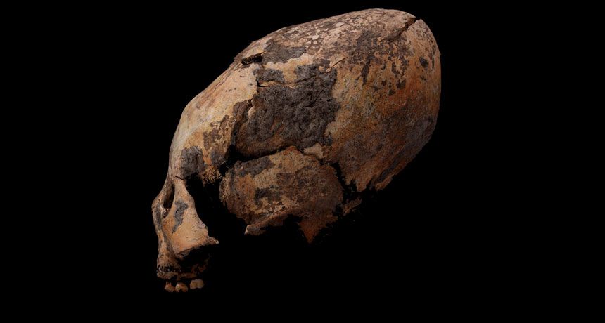 Ancient Chinese Graves Reveal Evidence of Early Skull Reshaping