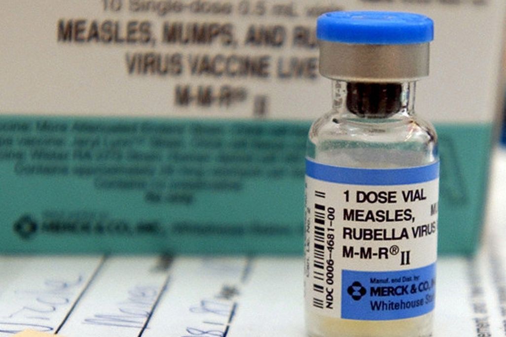 measles
