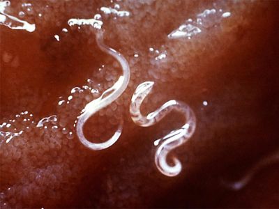 Evidence (some anecdotal and some clinical) suggests that hookworms could suppress the immune response in people with allergies and other inflammatory diseases. 