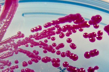 As part of a bioweapon experiment, Serratia marcescens (pictured on an agar plate above) was released in San Francisco back in 1950. 