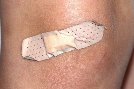 Did you get that injury during the night or day? It might be telling about how long it'll take to heal.