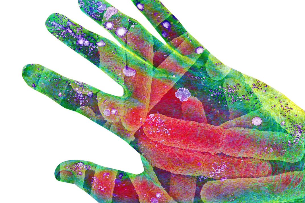 Bacteria on Hand