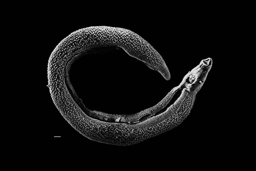 Schistosoma_20041-300.jpg