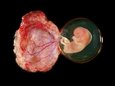 An eight-week old human fetus attached to its placenta