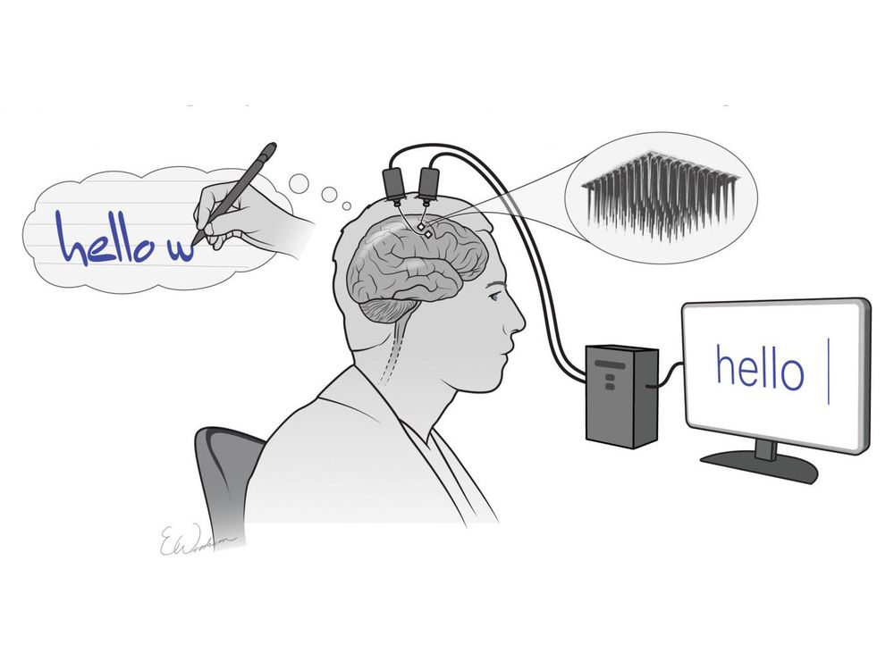 An illustration shows a man thinking about typing "hello w..." and he has electrical devices connecting his brain to a computer, which displays the word "hello"