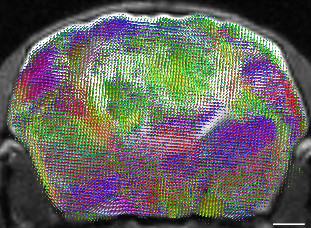 cross section of mouse brain