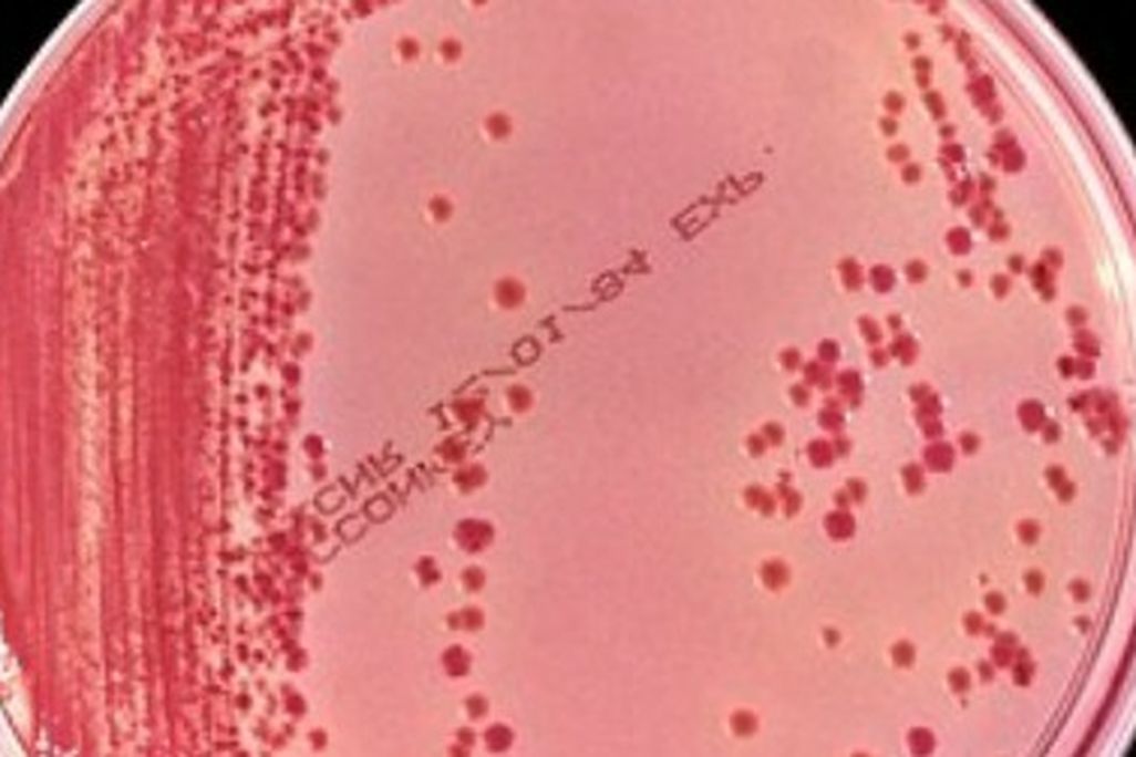 The superbug behind a deadly outbreak