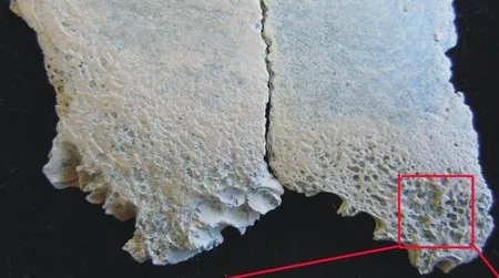 Skull fragments from a 2-year-old child (exterior view, top left; interior view, top right) that died 1.5 million years ago contain evidence of anemia. The blood disorder can lead to very porous bone (bottom left, right).