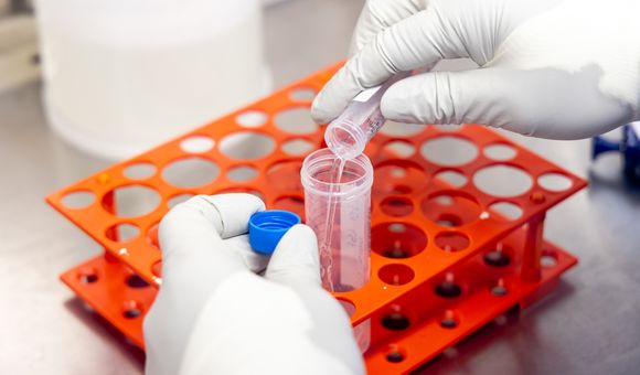 A sample of cerebrospinal fluid