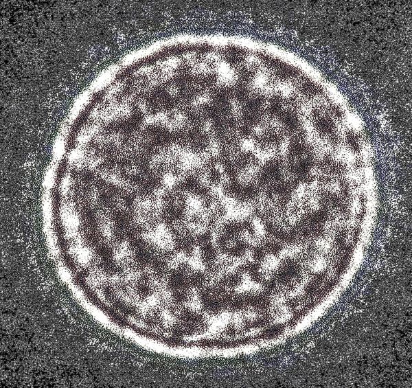 Baltis Vallis thumbnail