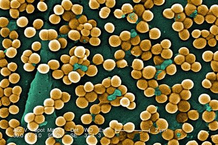 Methicillin-resistant Staphylococcus aureus