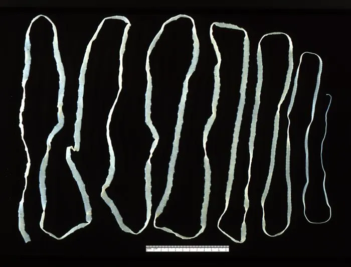 A tapeworm (but a different species than what lives in woodcocks). Photo: CDC