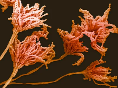 Spores on the conidiophores of the fungus Penicillium notatum.