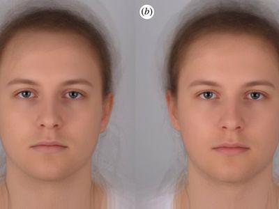 Can you tell which is the face of someone who is sick? Take a good look. Images of 16 individuals (eight women) photographed twice were averaged, during experimentally induced (a) acute sickness and (b) placebo.