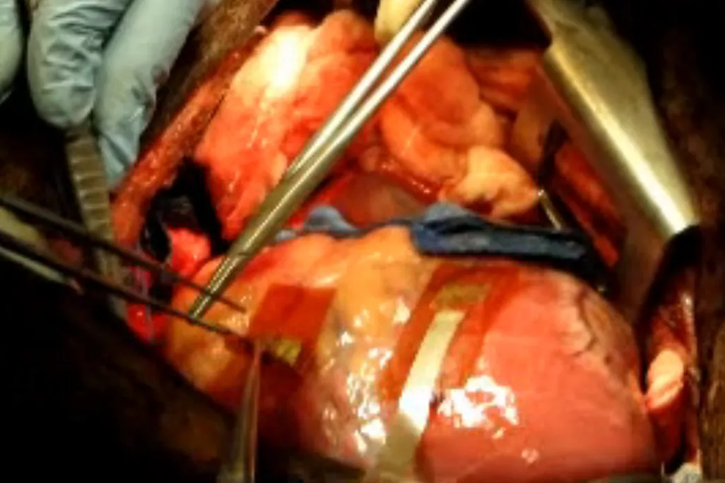 01_23_2014_piezoelectric heart.jpg