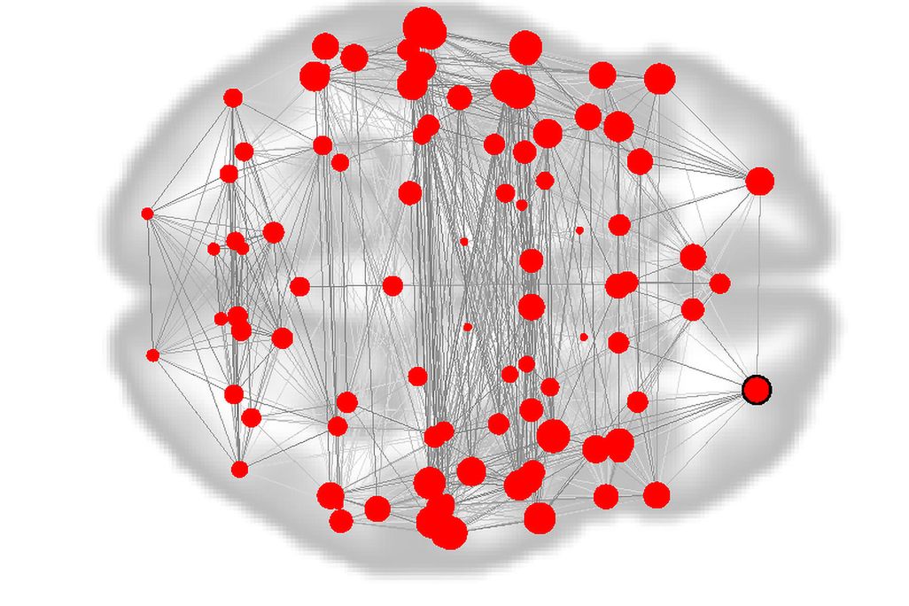 Brain Fingerprint Graphic