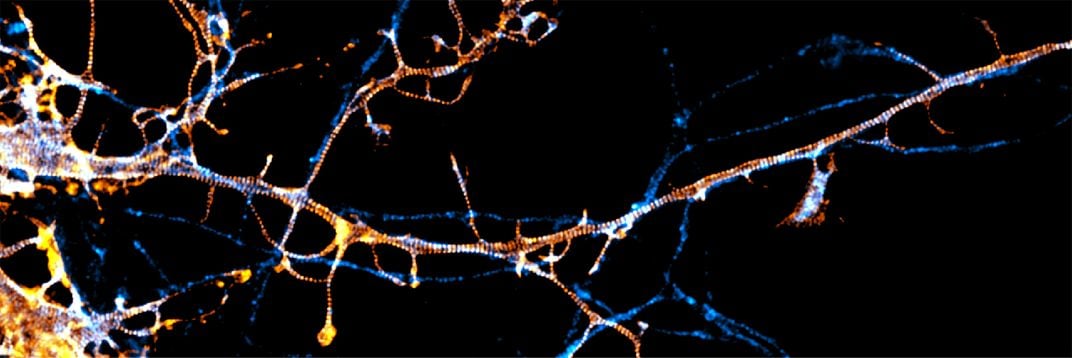 Nerve Cells Skeleton