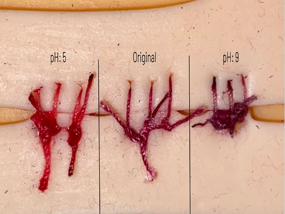 This High Schooler Invented Color-Changing Sutures to Detect Infection