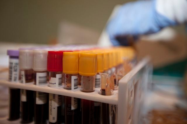 blood vials