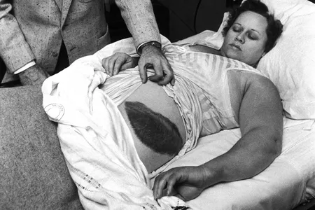 In the hubbub after the meteorite strike, Ann Hodges became a minor celebrity. Photographs of her bruise and the damage to her home appeared in Life magazine in an article entitled, “A Big Bruiser From the Sky.” 