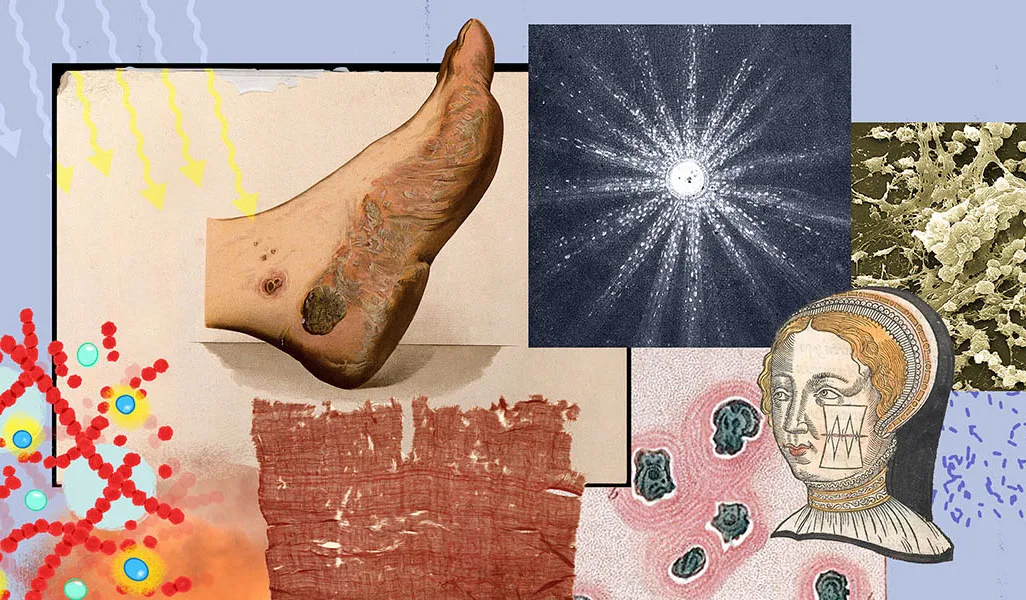light-nano-wound-1600x600.jpg
