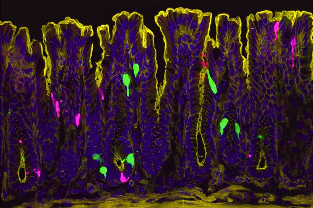 image showing cells in the colon, with those that produce PYY in green and those that produce serotonin in magenta