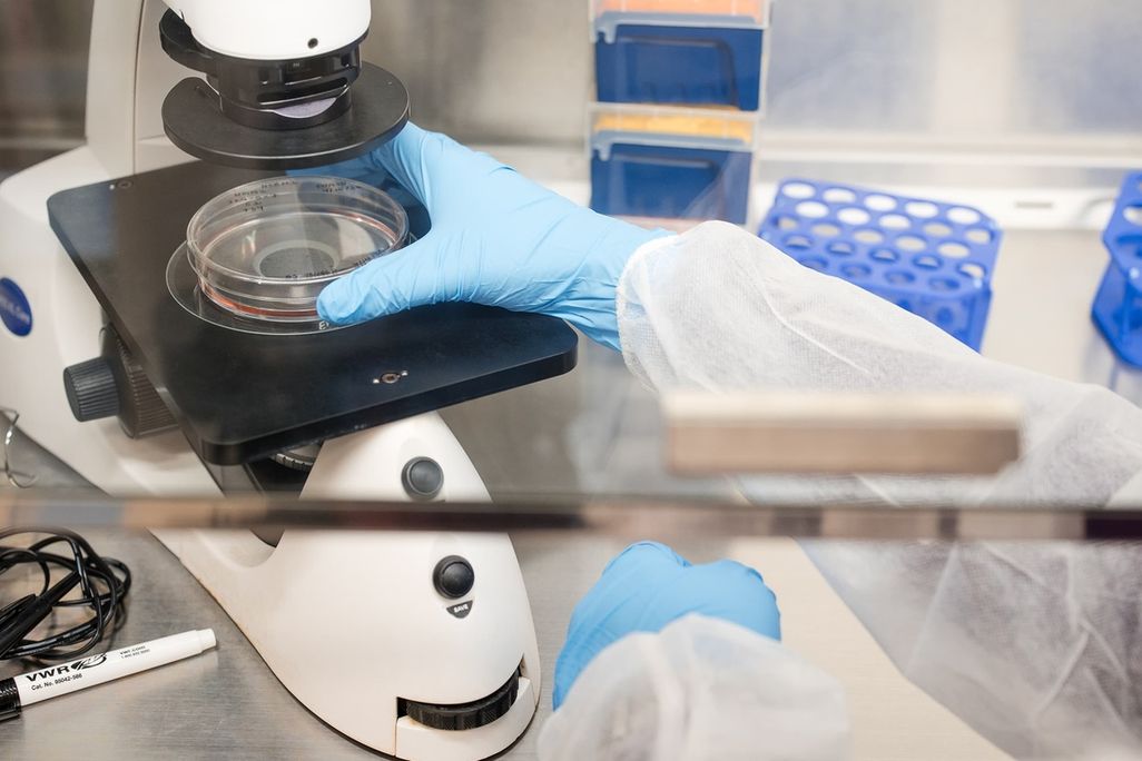 a gloved hand putting a dish under a microscope