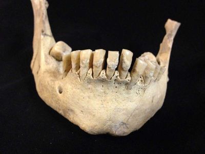 Archaeologists found traces of a milk protein in seven prehistoric Britons' calcified dental plaque