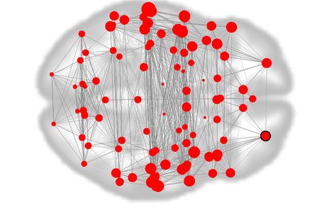 This functional connectivity map, a kind of &ldquo;fingerprint&rdquo; of the brain, displays how different regions interact with each other in 12-year-olds.&nbsp;The map was constructed from resting-state MRIs, where participants were lying down and not completing a task. Larger red circles denote brain &ldquo;nodes&rdquo; with more connections.