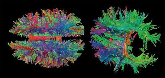 Beauty of the Brain