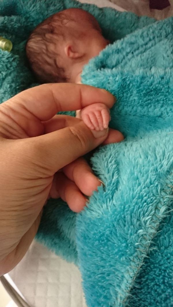 Hand in Fingers thumbnail