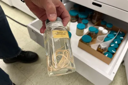 A jar containing Ascaris, a parasitic worm that affects over one billion people worldwide