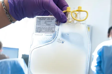 Genetically modified immune cells ready to be reintroduced back into a person and attack leukemia.