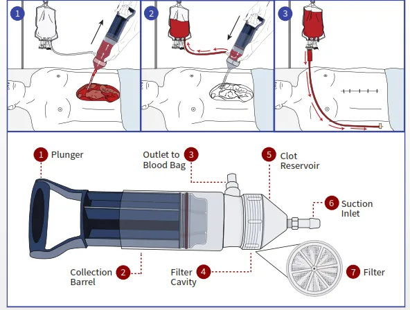 This Pump Could Make Blood Transfusions Safer and Cheaper in the Developing World