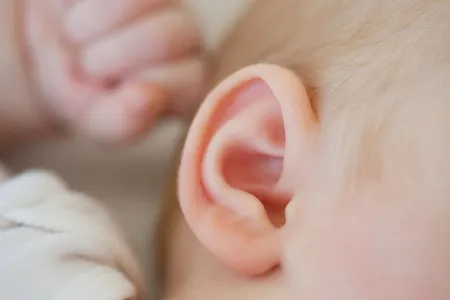 A technique for implanting a 3D-printed "ear" with stem cells could revolutionize treatment for microtia patients.