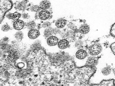 This transmission electron microscopic image shows the pandemic coronavirus SARS-CoV-2. 