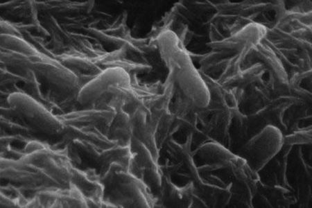 Shewanella oneidensis
